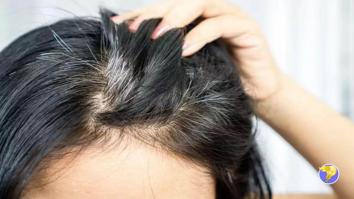 Cheveux Blancs: 4 Méthodes Naturelles Pour Se Débarrasser